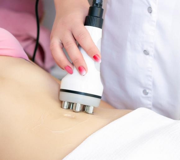 lipocavitation