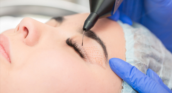 Plasma lift