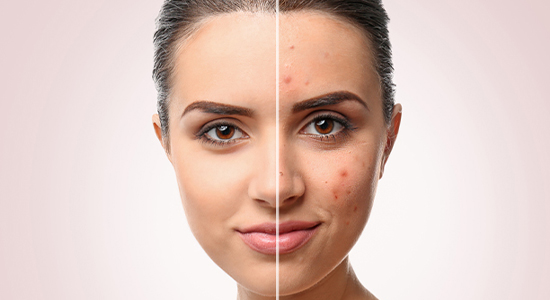 Skin repair